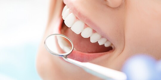 sản phẩm của 3M cho phục hồi răng trước
