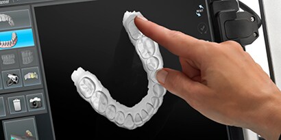 Digital Dental Impressions
