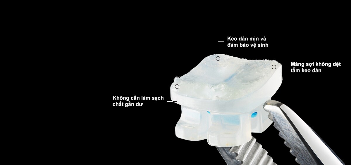 Hệ thống khí cụ chỉnh nha phủ keo APC™ Flash-Free
