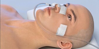 Video hướng dẫn cách cố định ống Foley quan trọng.
