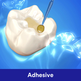 clinpro dental varnish dùng cho phòng ngừa sâu răng hiệu quả