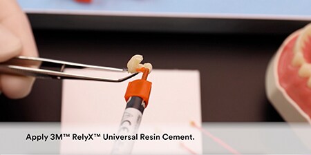 Bôi xi măng 3MTM RelyxTM Universal.
