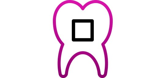 Định vị mắc cài trên răng
