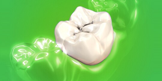 phục hồi composite xoang 1

